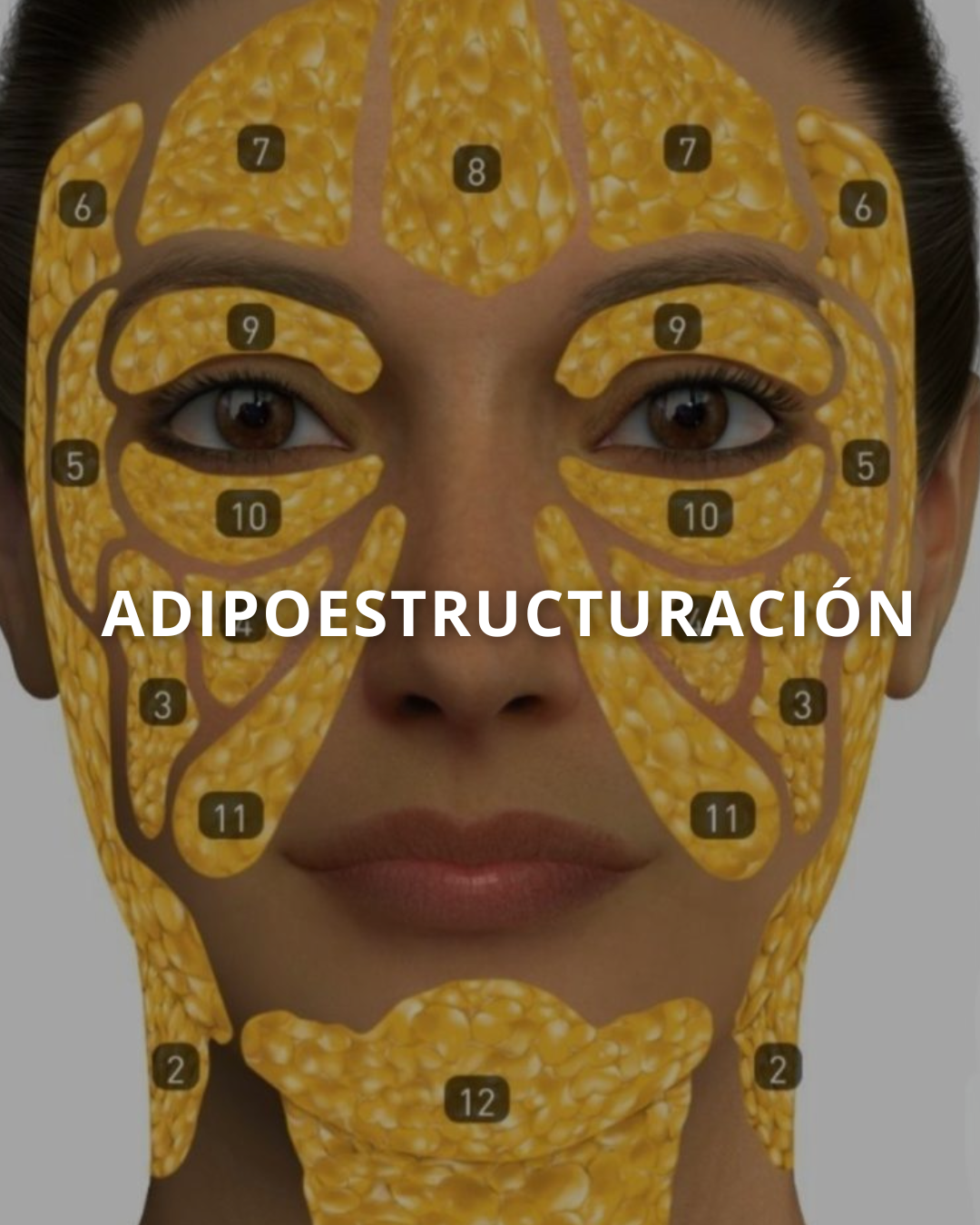 Tratamiento 6