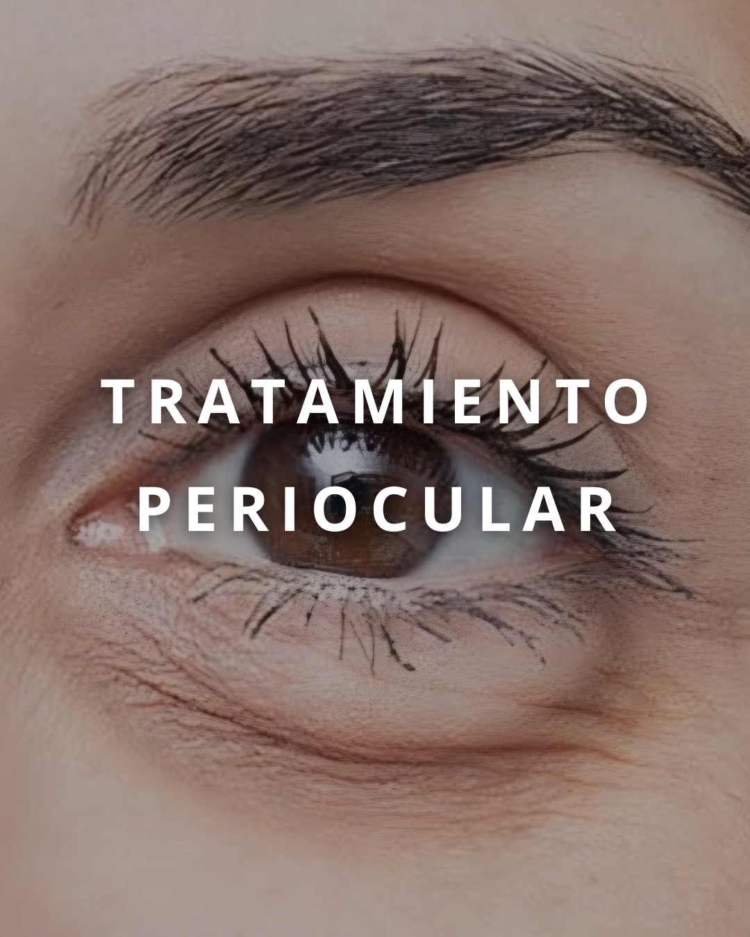 Tratamiento 4
