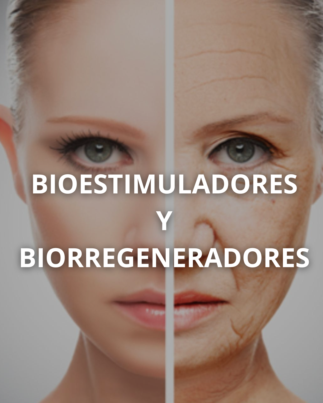 Tratamiento 3
