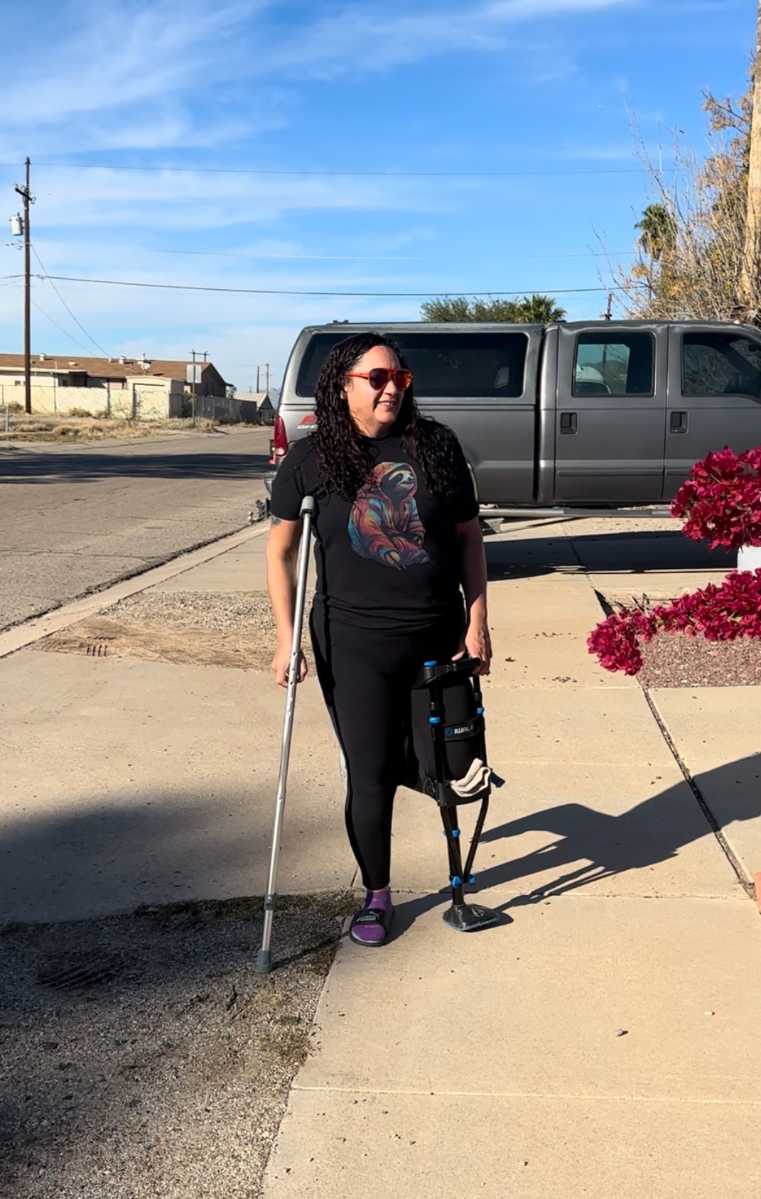 Fear of movement after ankle replacement