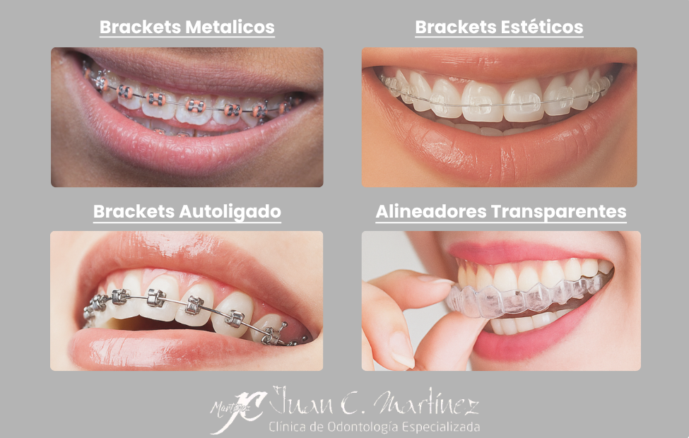 Planificación digital de ortodoncia en Cali — Dr. Juan Carlos Martínez