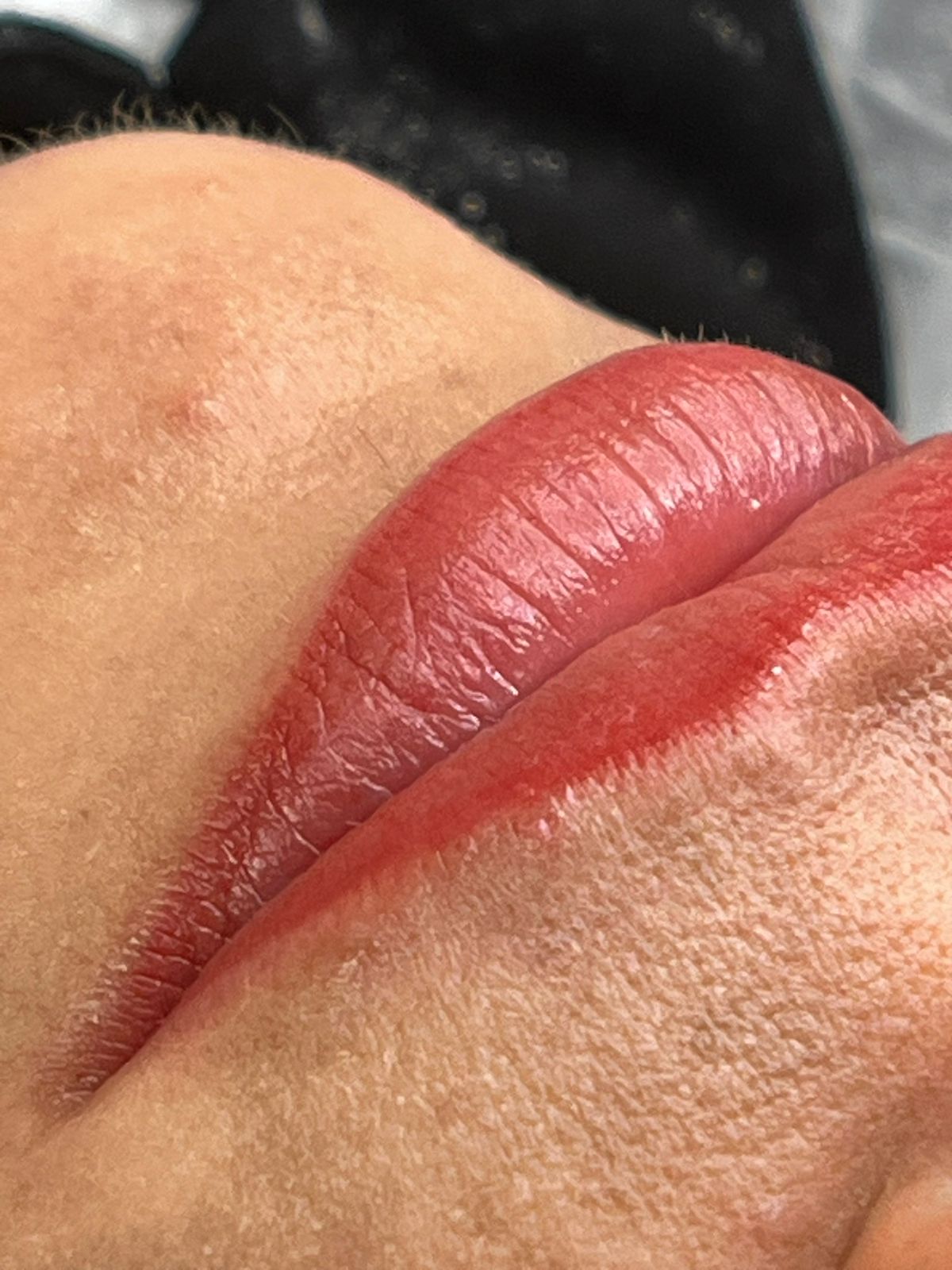 3D Lips — résultat 2