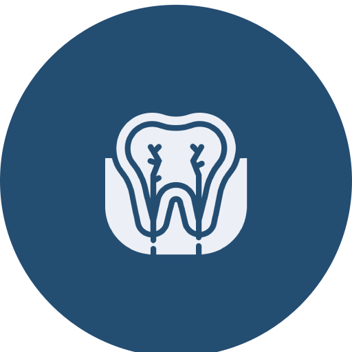 Root Canal