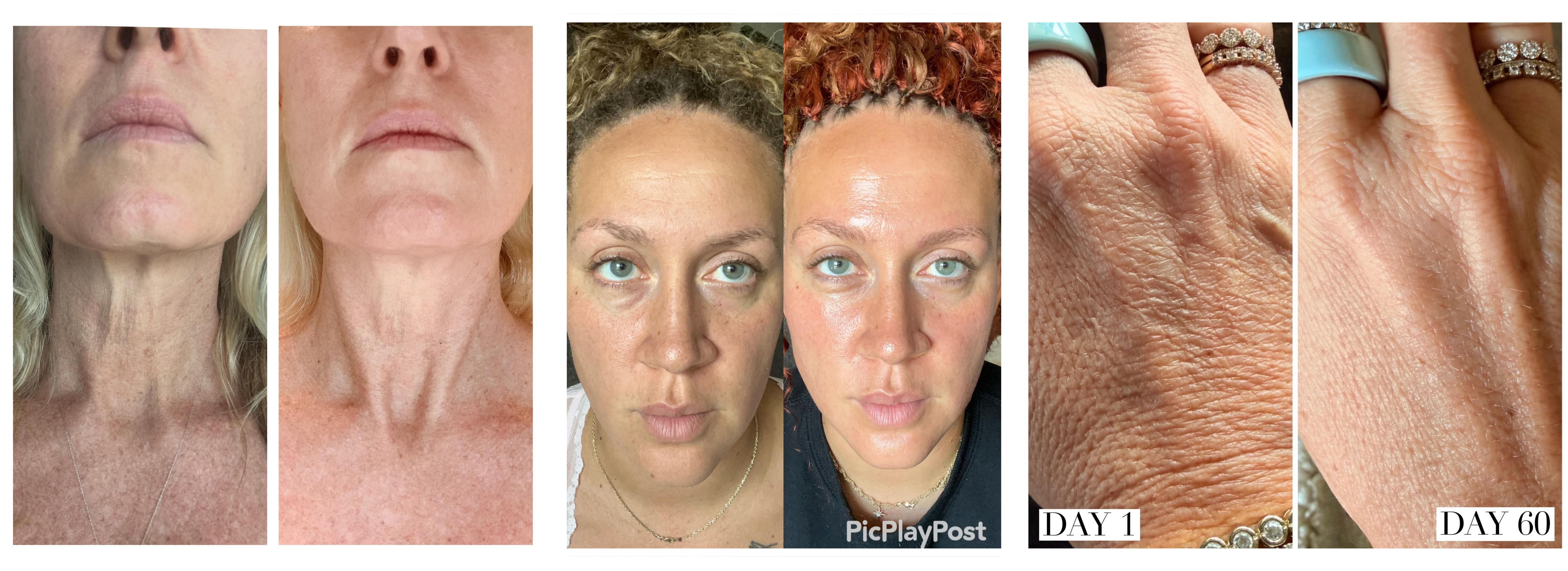 60 days of using Precision Skincare by MAKE Wellness 60 days of using Precision Skincare by MAKE Wellness