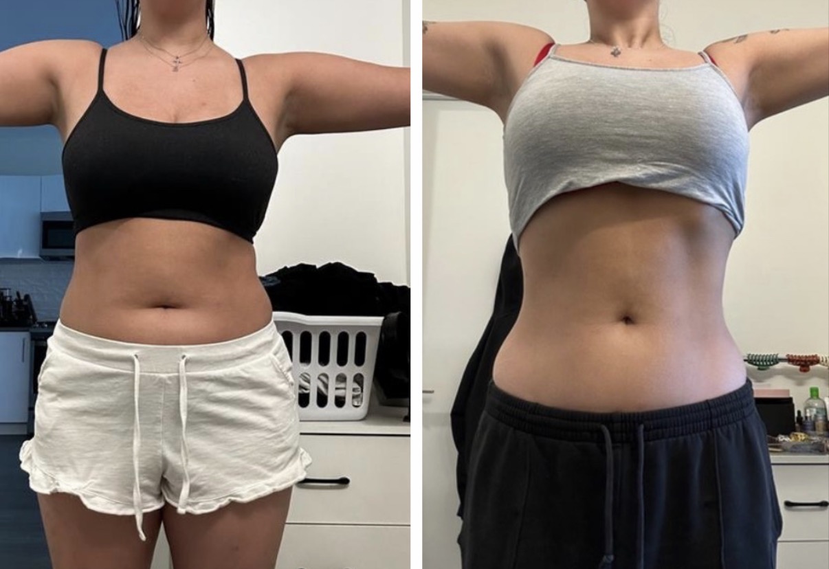 Nicole's side-by-side transformation photos