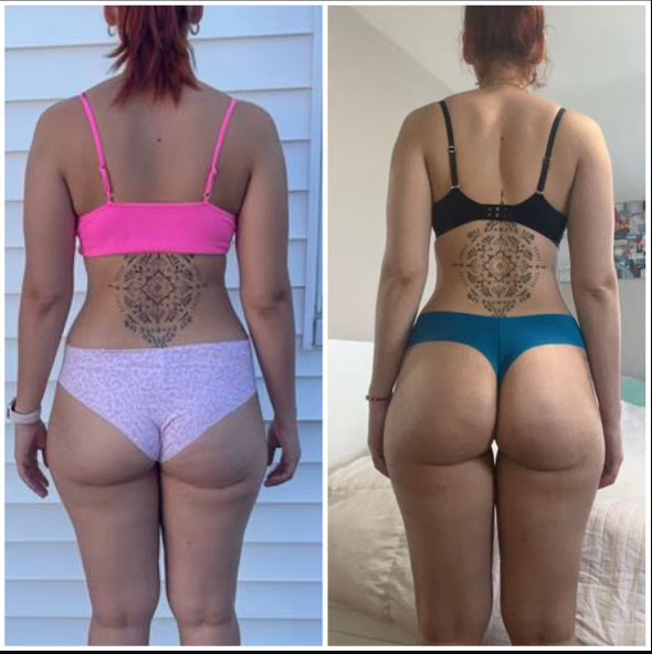 Estefania Velasquez's side-by-side back transformation comparison photos