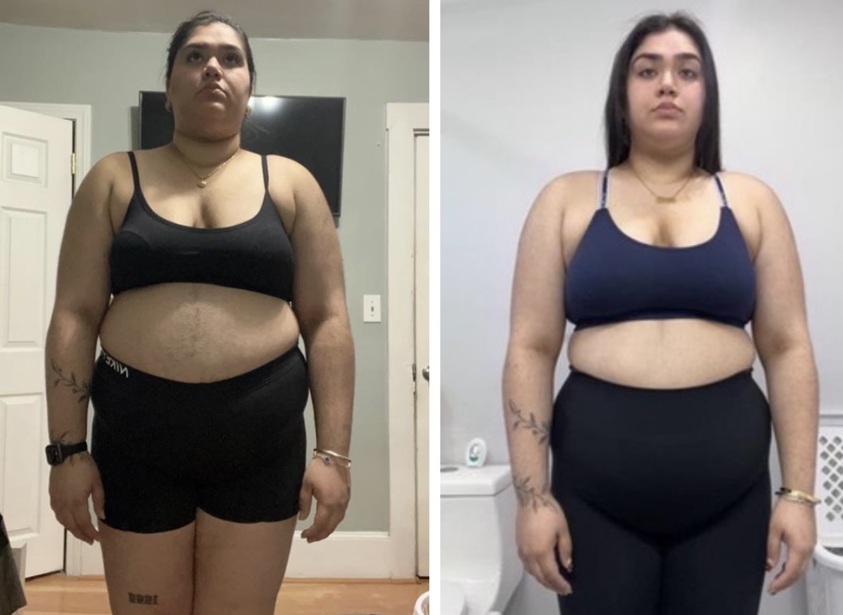 Gurleen Hayer's side-by-side front transformation comparison photos