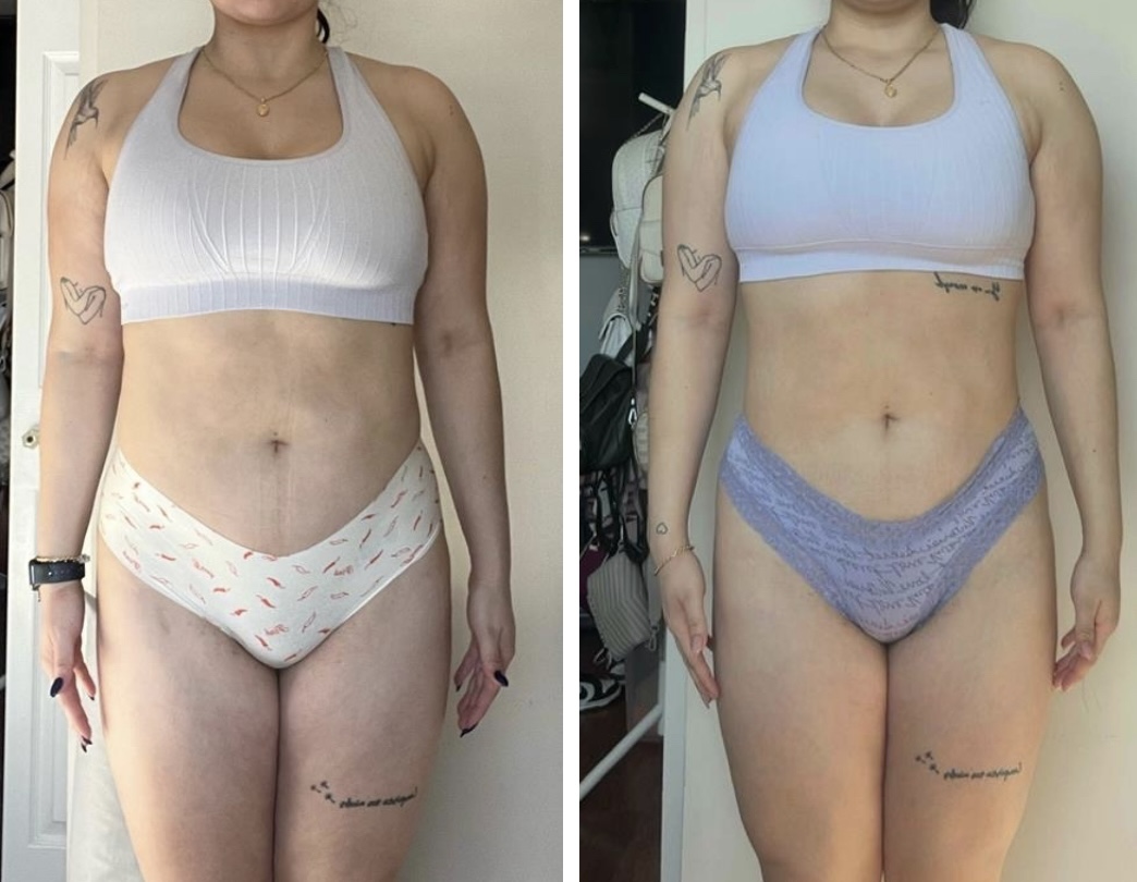 Alejandra Villa's side-by-side front transformation comparison photos