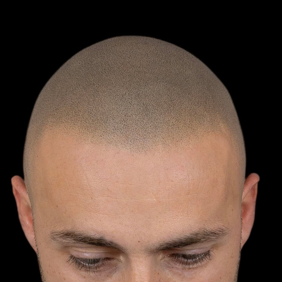 Dopo