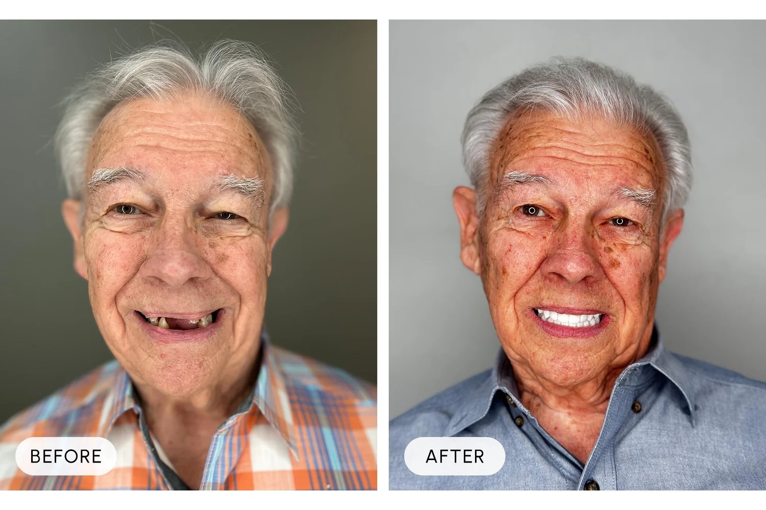 Bellaire Modern Dental before and after example 4