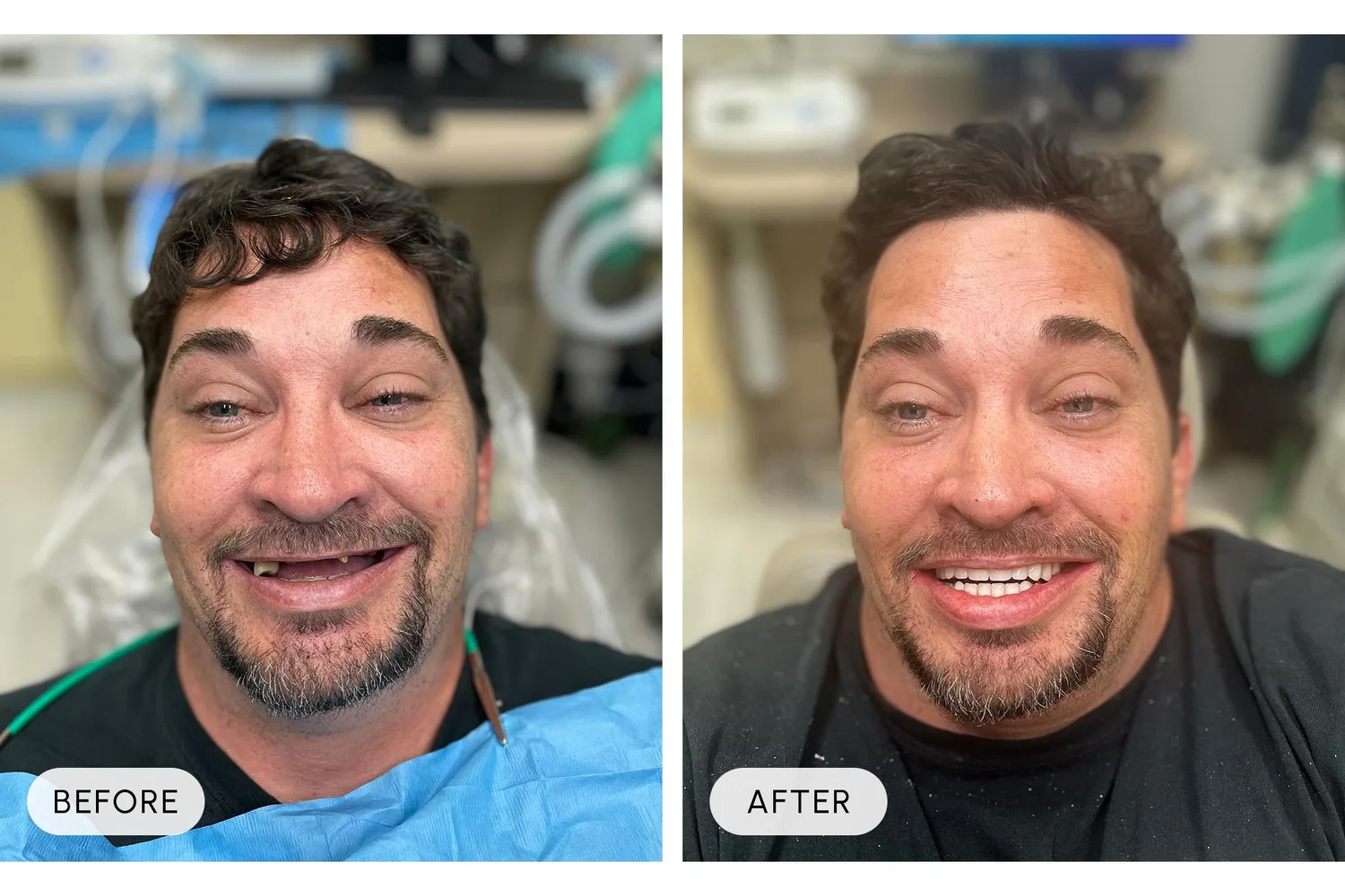 Bellaire Modern Dental before and after example 3