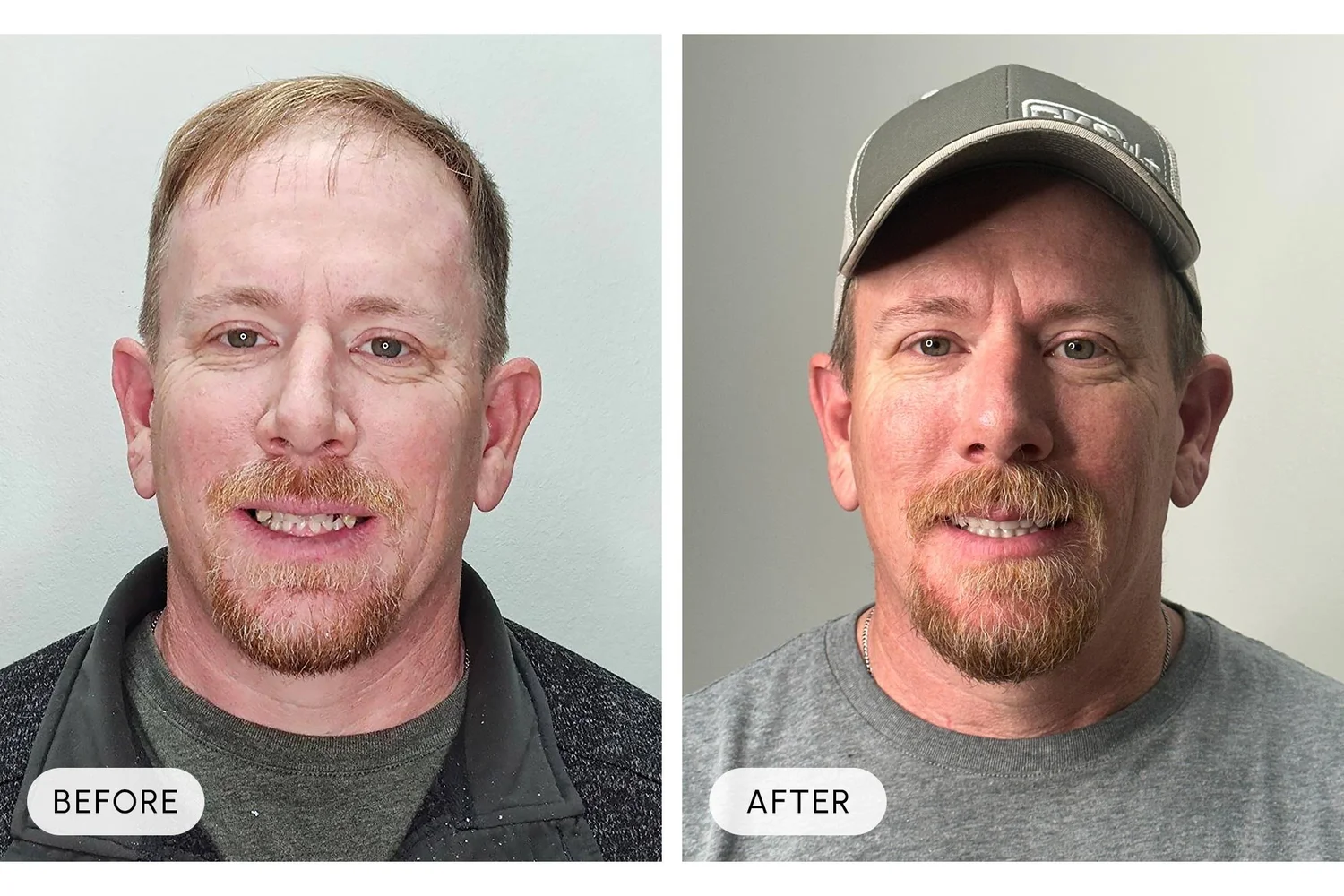 Bellaire Modern Dental before and after example 5