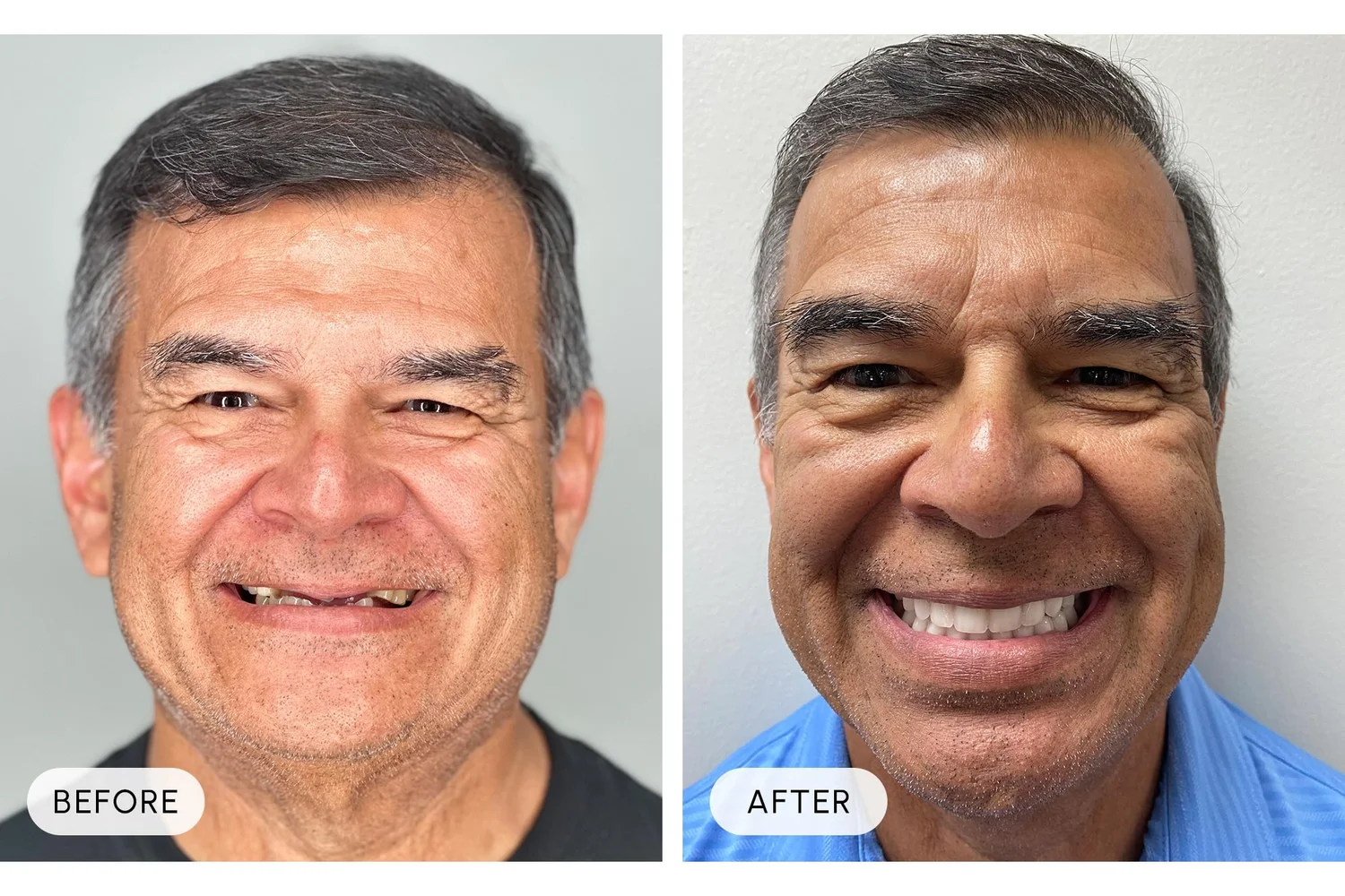 Bellaire Modern Dental before and after example 6