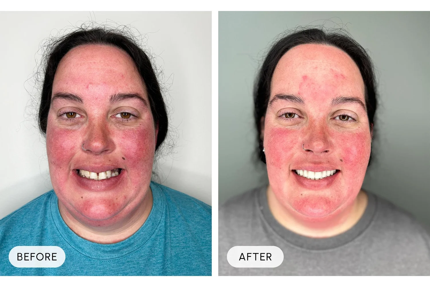 Bellaire Modern Dental before and after example 11