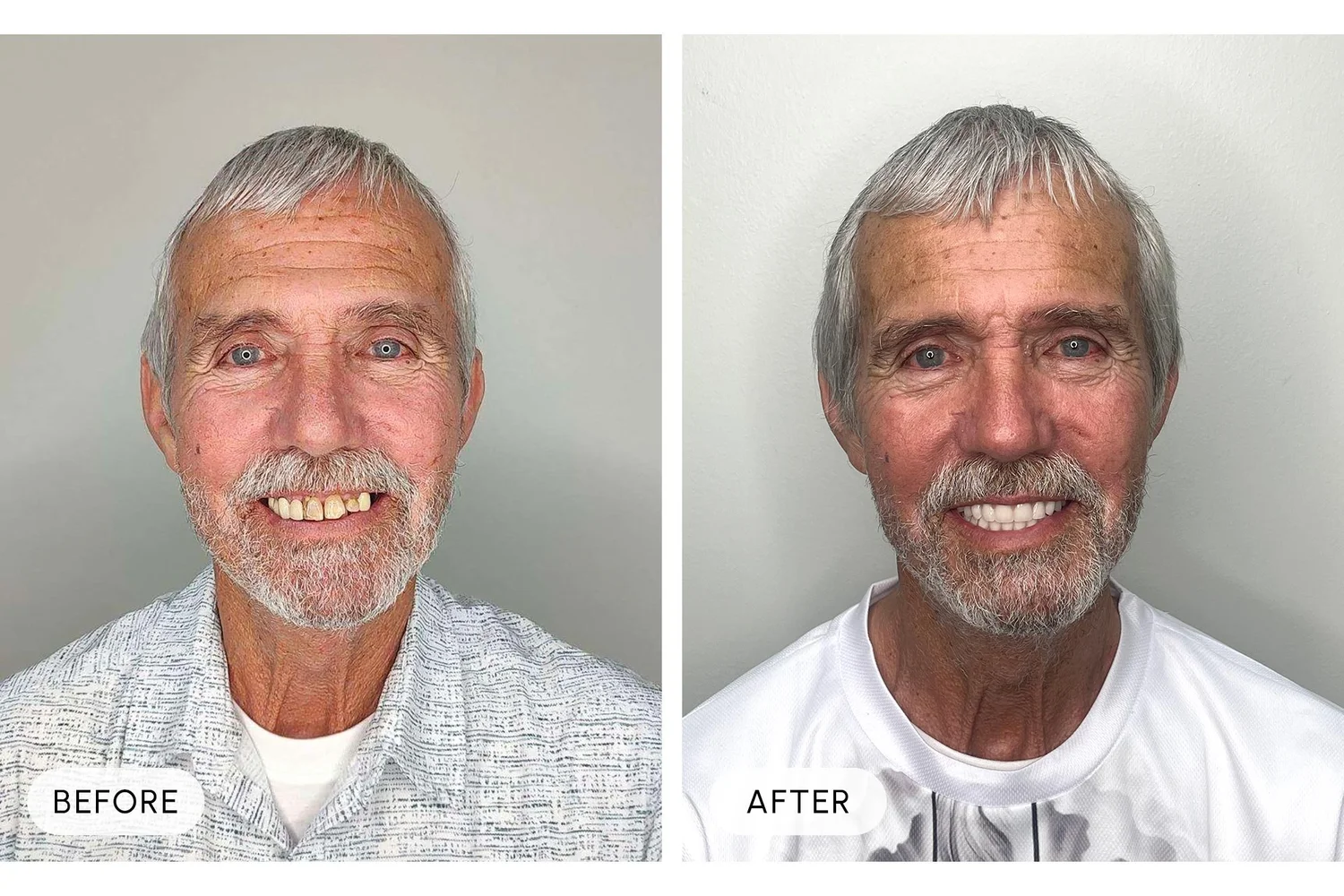 Bellaire Modern Dental before and after example 7