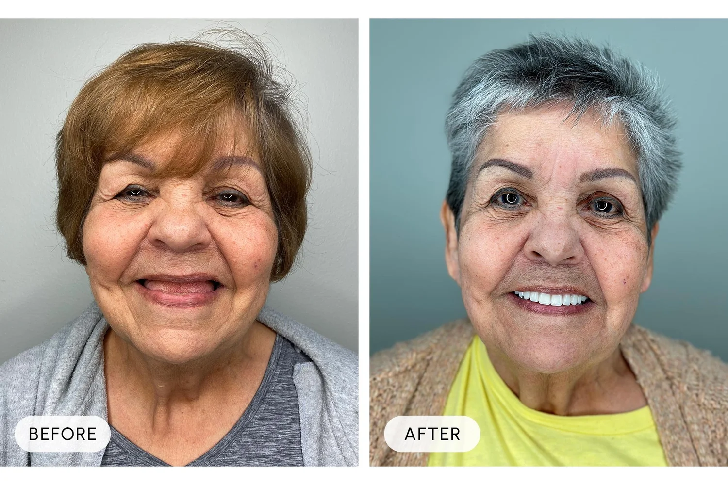 Bellaire Modern Dental before and after example 10