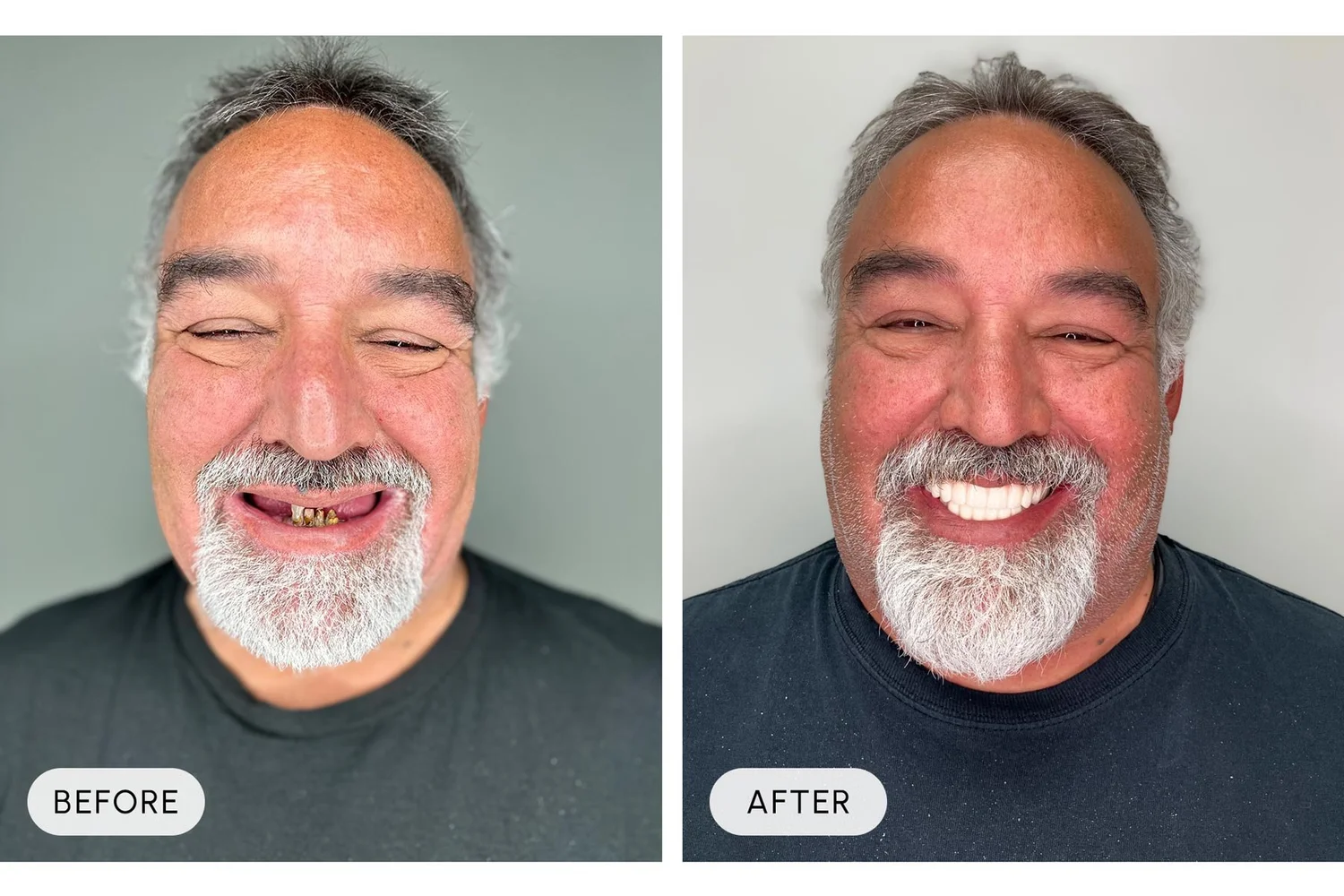 Bellaire Modern Dental before and after example 12