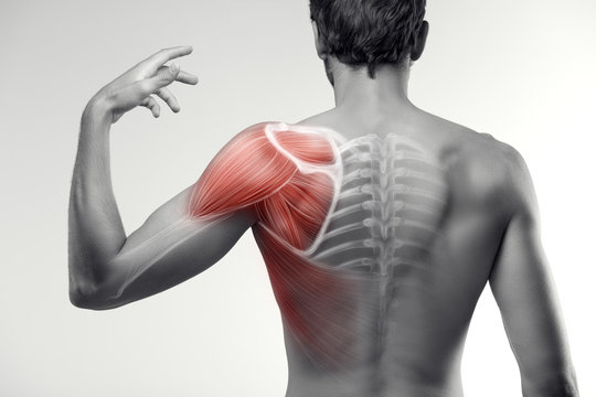 shoulder pain 