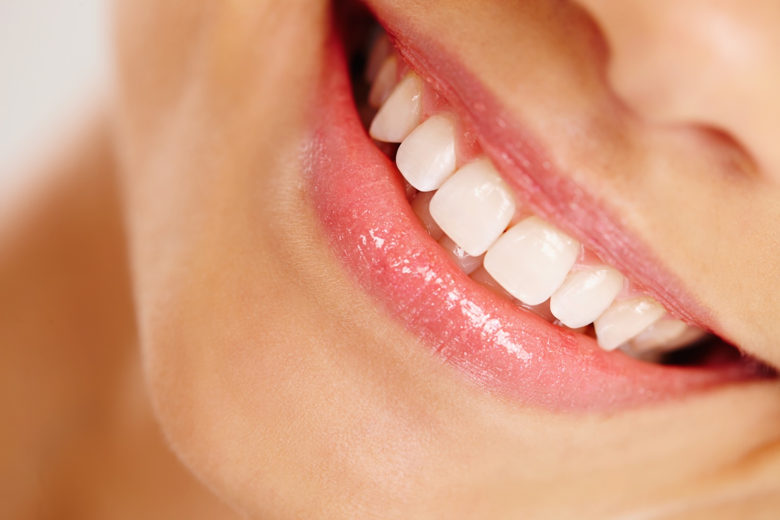 Woman with a natural, confident smile after a smile makeover at Impact Dental Liverpool