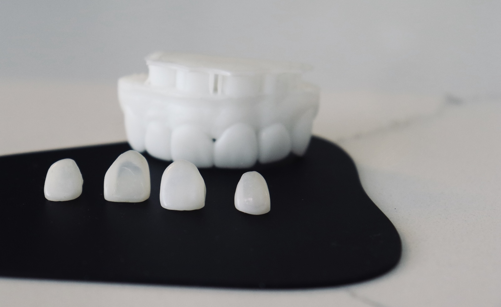 Porcelain dental veneers at Impact Dental Liverpool