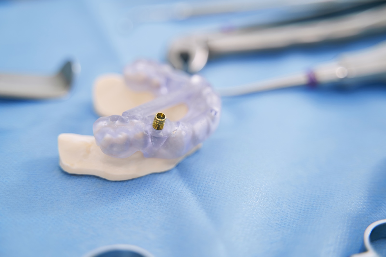 Full arch All-on-4 dental implants at Impact Dental Liverpool