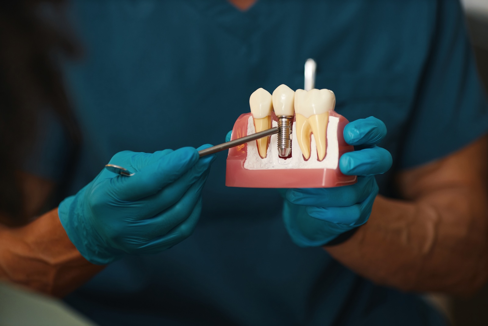 Woman with a confident, natural smile after dental implants at Impact Dental Liverpool