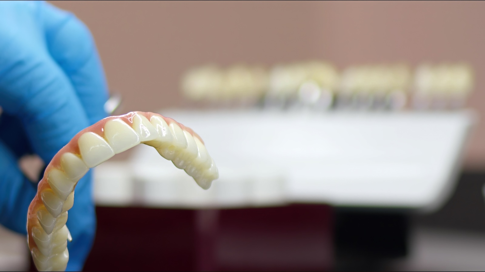 Full arch zirconia dental implants at Impact Dental Liverpool