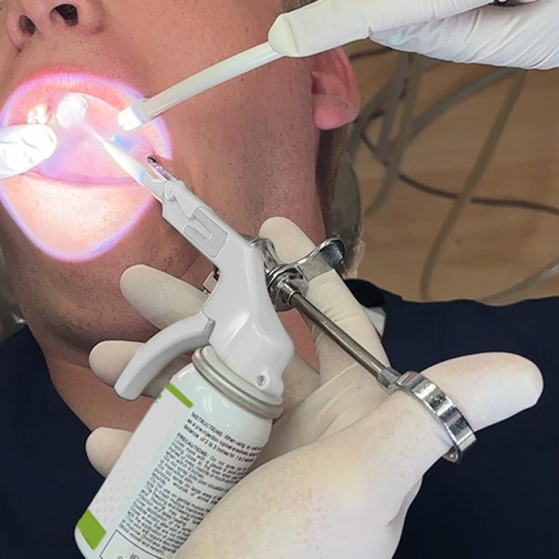 Apply spray for 1 to 2 seconds to target area Image