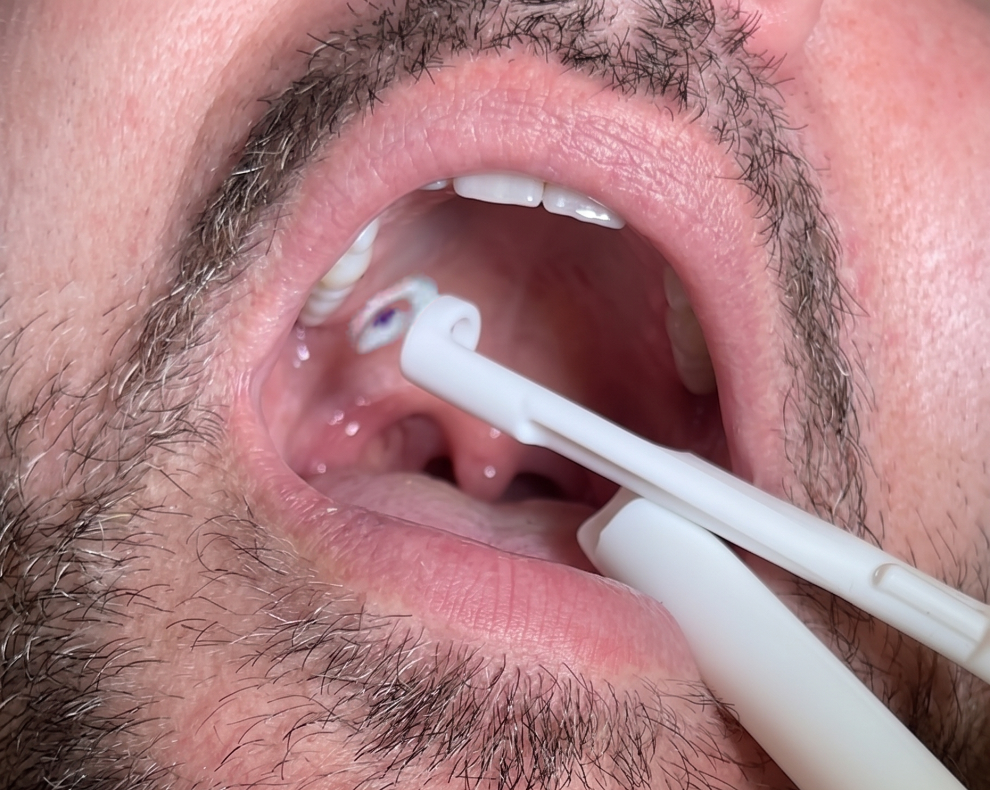 Apply spray for 1 to 2 seconds to target area Image