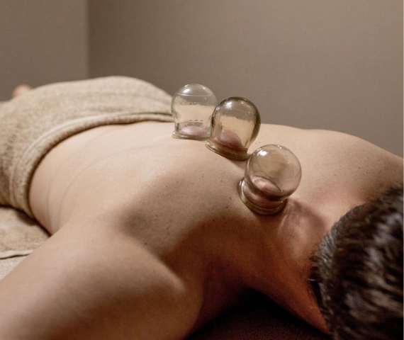 Cupping Therapy