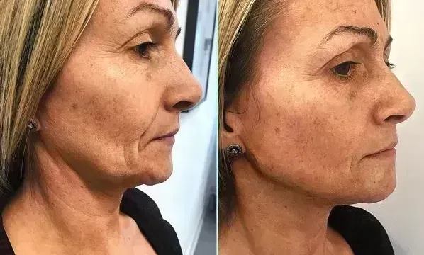 Client result example