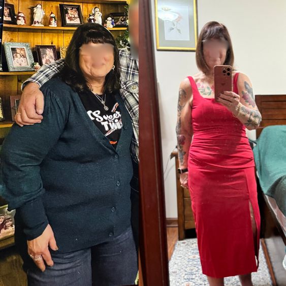 Laurie, M3 client, 100 pounds lost