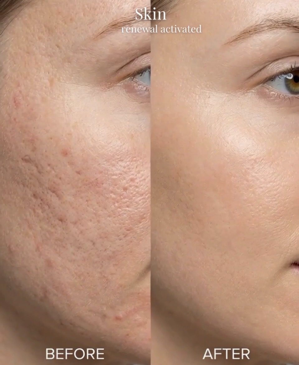 Scar camouflage at Beauty Ink