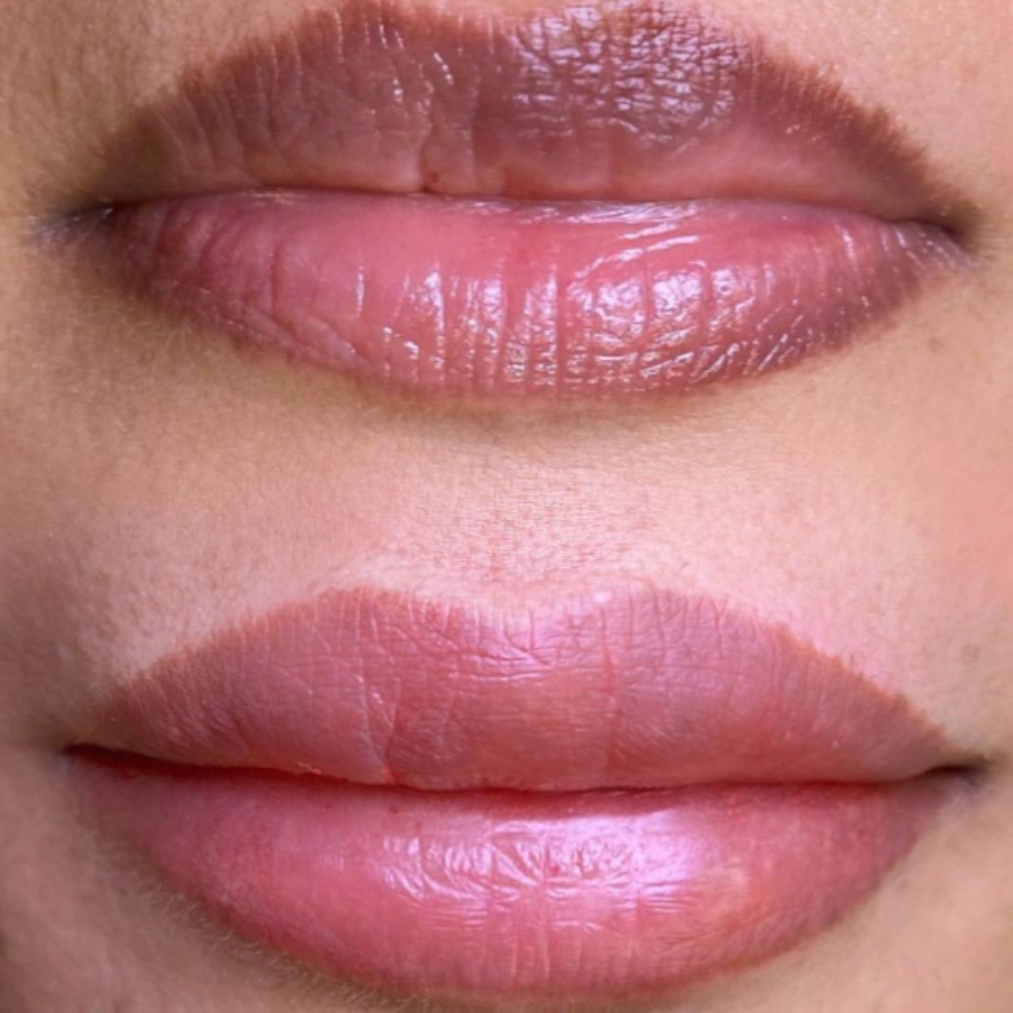 Lip Blush real client results