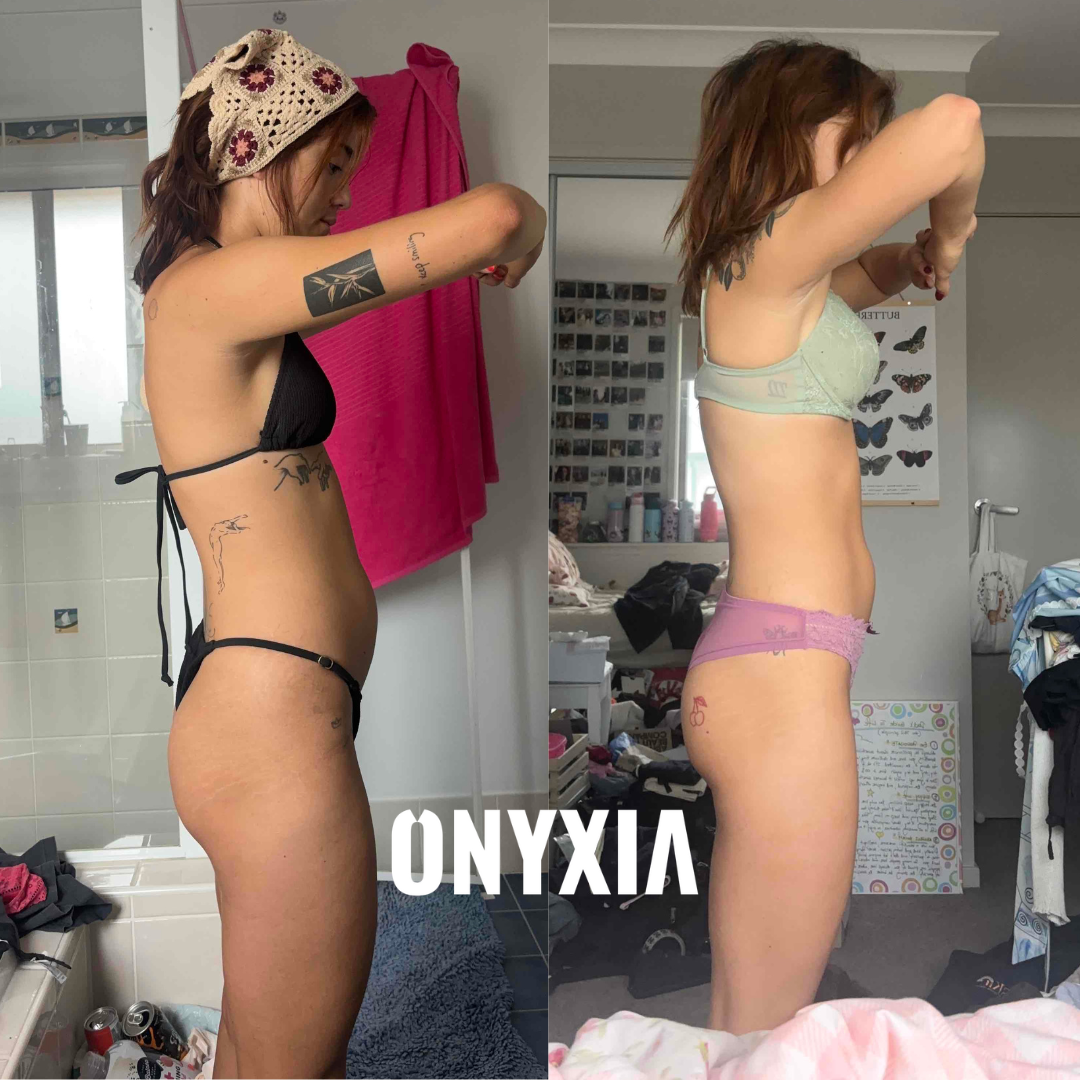 Alexandra, before and after