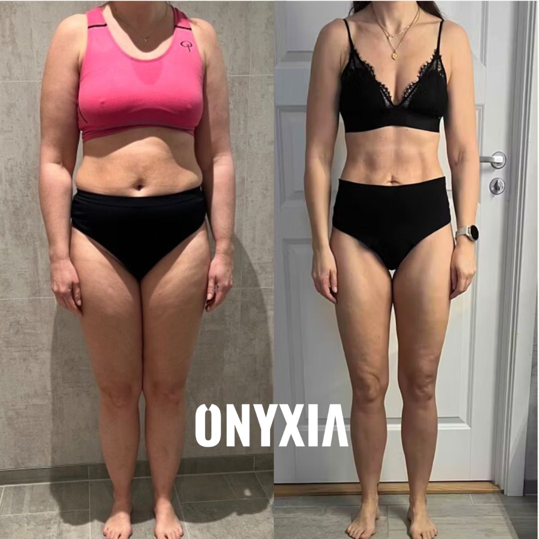 Linn, before and after