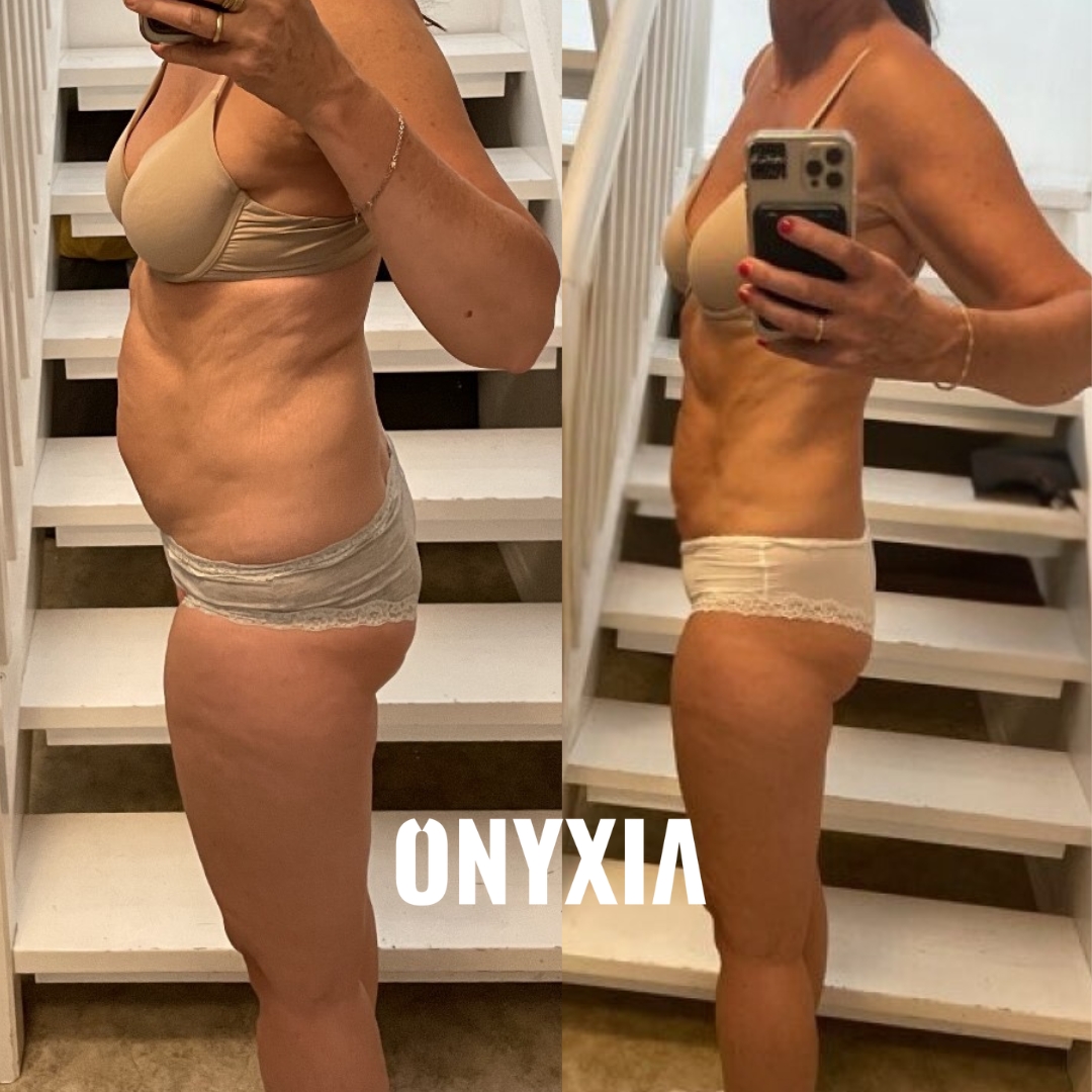 Trude, before and after, 4 months