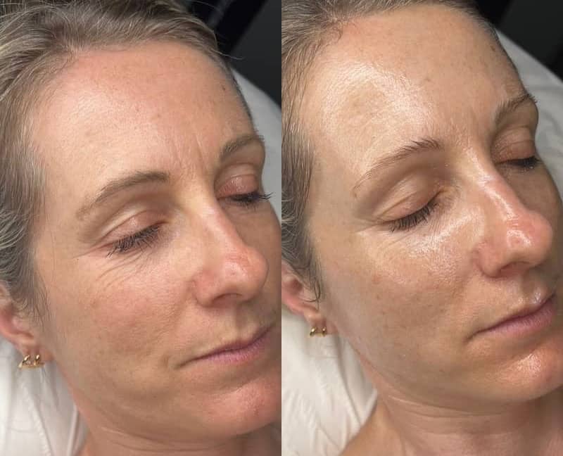 Transformation 2