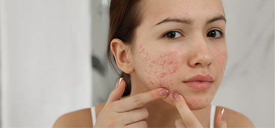 Clarifying Facial