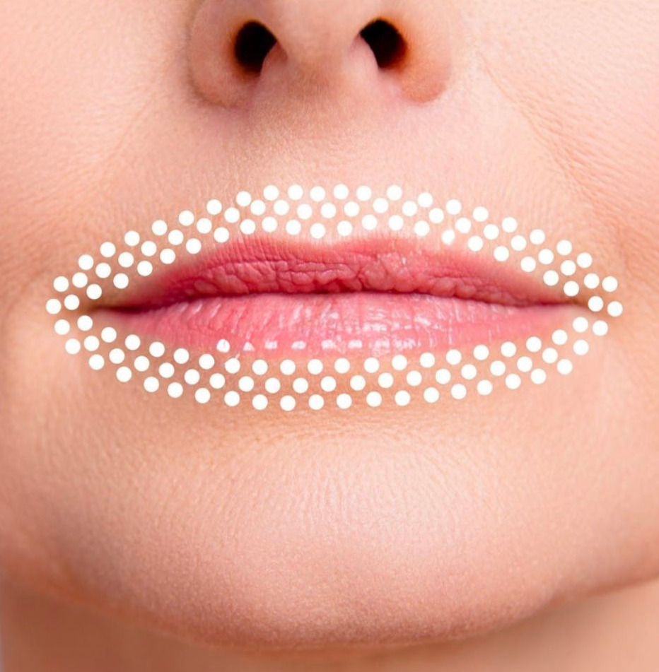 Pout Perfector