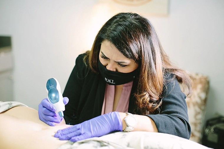 Plasma Fibroblast Specialists Fort Collins