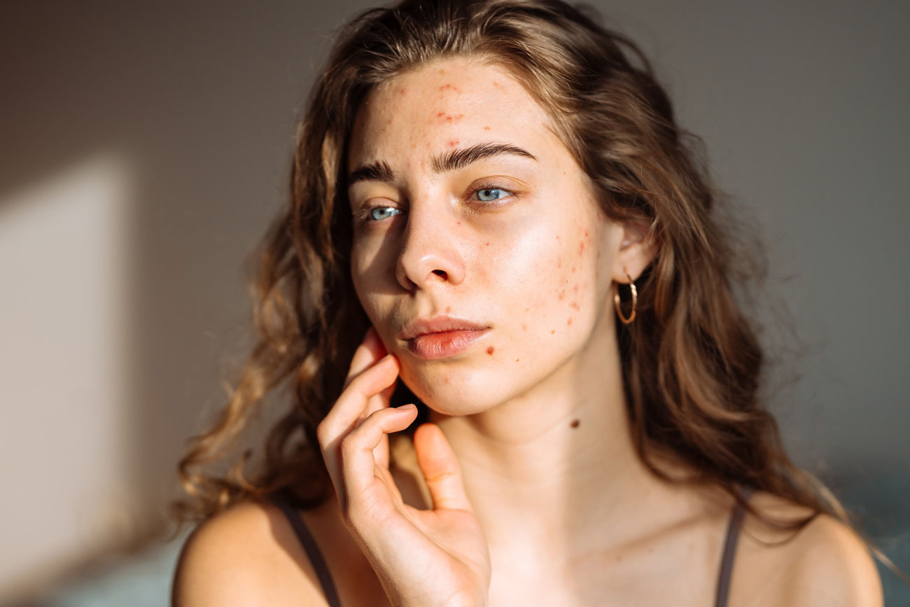 Is Dermaplaning Right For You
