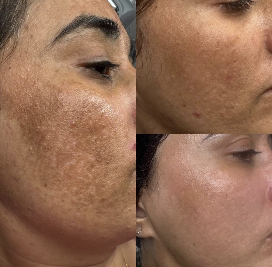 See exactly what your skin needs for $49 this winter at Amor Sui Aesthetic Clinic