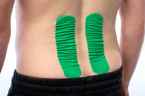 Kinesio Taping Therapy