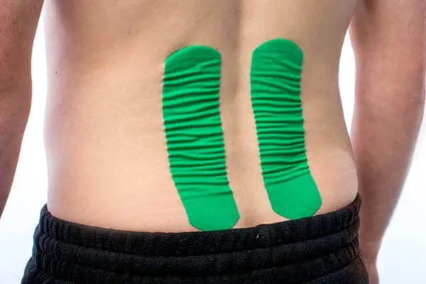 Kinesio Taping Therapy