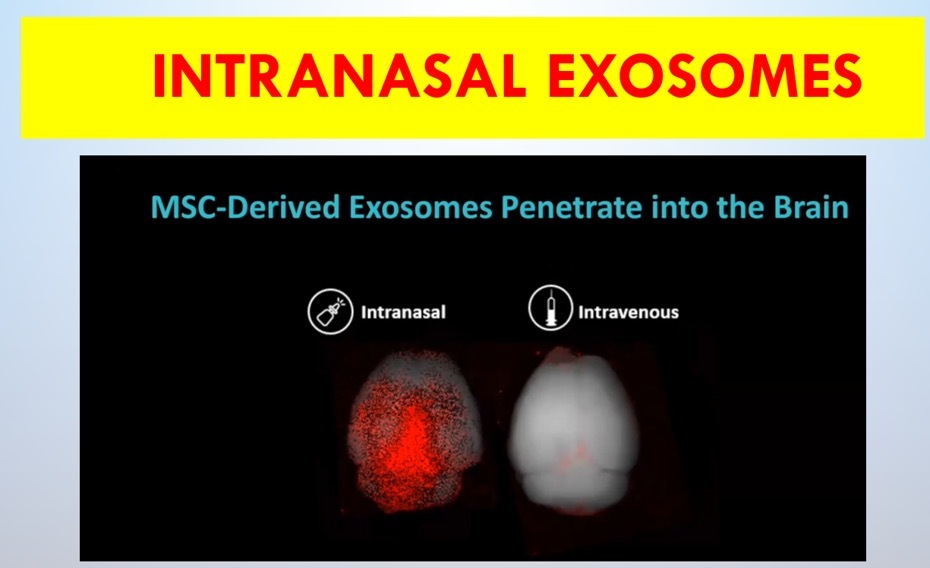 Intranasal exosomes penetrate the brain — research scan comparison