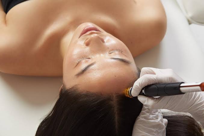 Scalp Treatment Partial
