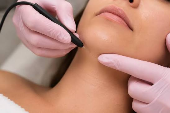 Electrolysis 15m