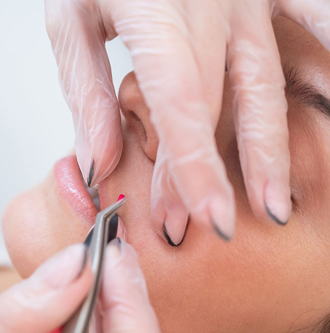 Electrolysis 30m