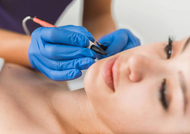 Electrolysis 45m